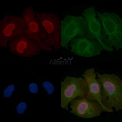 FOXD2 Mouse Monoclonal Antibody - BF8848 staining Hela cells by IF/ICC.