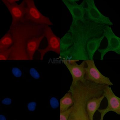POLR2A Mouse Monoclonal Antibody - BF8865 staining Hela cells by IF/ICC.
