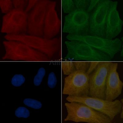 GSDMA Mouse Monoclonal Antibody - BF8888 staining Hela cells by IF/ICC.