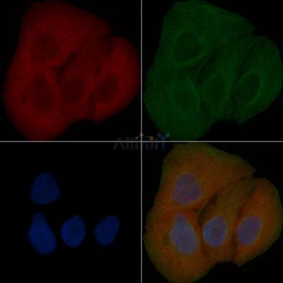 CEP104 Mouse Monoclonal Antibody - BF8890 staining Hela cells by IF/ICC.