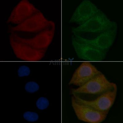 TMEM63C Mouse Monoclonal Antibody - BF8898 staining Hela cells by IF/ICC.