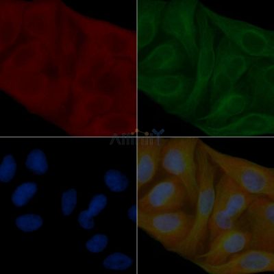 Annexin A2 Mouse Monoclonal Antibody - BF8964 staining Hela cells by IF/ICC.
