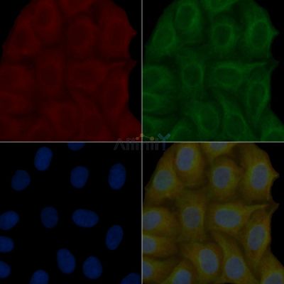 EPS15 Mouse Monoclonal Antibody - BF8965 staining Hela cells by IF/ICC.