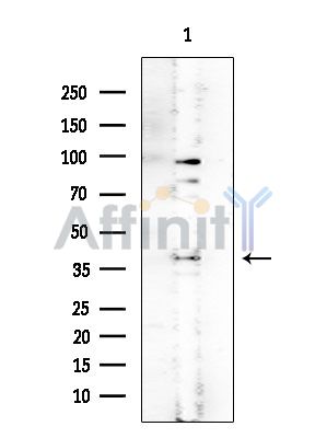 GNPDA1 Mouse Monoclonal Antibody - Western blot analysis of extracts from EC304 cells, using GNPDA1 Mouse Monoclonal Antibody at 1/1000 dilution.