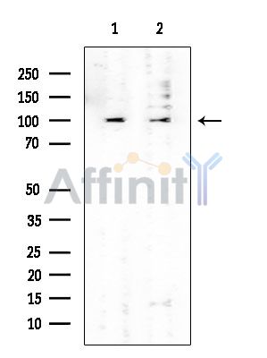 HEATR2 Mouse Monoclonal Antibody - Western blot analysis of extracts from various samples, using HEATR2 Mouse Monoclonal Antibody at 1/1000 dilution.