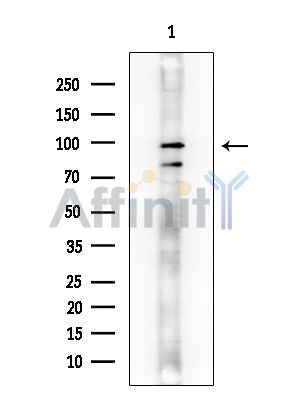 IP3KC Mouse Monoclonal Antibody - Western blot analysis of extracts from EC304 cells, using IP3KC Mouse Monoclonal Antibody at 1/1000 dilution.