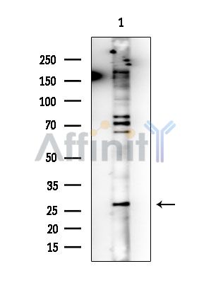 KLF6 Mouse Monoclonal Antibody - Western blot analysis of extracts from EC304 cells, using KLF6 Mouse Monoclonal Antibody at 1/1000 dilution.