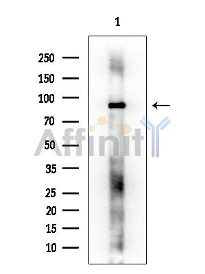 PTK7 Mouse Monoclonal Antibody - Western blot analysis of extracts from EC304 cells, using PTK7 Mouse Monoclonal Antibody at 1/1000 dilution.