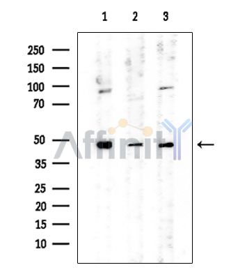 TUBD1 Mouse Monoclonal Antibody - Western blot analysis of extracts from various samples, using TUBD1 Mouse Monoclonal Antibody at 1/1000 dilution.