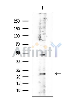 PGRMC2 Mouse Monoclonal Antibody - Western blot analysis of extracts from Rat testis, using PGRMC2 Mouse Monoclonal Antibody at 1/1000 dilution.