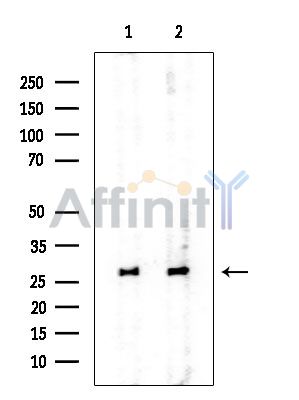 RPL10A Mouse Monoclonal Antibody - Western blot analysis of extracts from various samples, using RPL10A Mouse Monoclonal Antibody at 1/1000 dilution.