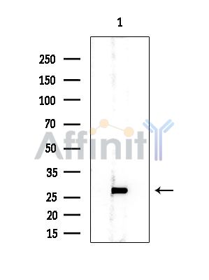 RPL10A Mouse Monoclonal Antibody - Western blot analysis of extracts from EC304 cells, using RPL10A Mouse Monoclonal Antibody at 1/1000 dilution.
