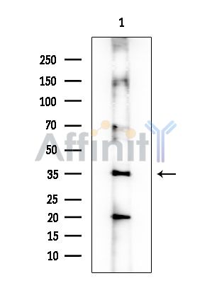 IL15RA Mouse Monoclonal Antibody - Western blot analysis of extracts from Mouse lung, using IL15RA Mouse Monoclonal Antibody at 1/1000 dilution.