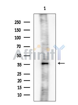 CLNS1A Mouse Monoclonal Antibody - Western blot analysis of extracts from EC304 cells, using CLNS1A Mouse Monoclonal Antibody at 1/1000 dilution.