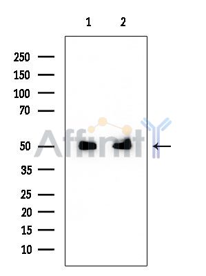 SEPT6 Mouse Monoclonal Antibody - Western blot analysis of extracts from various samples, using SEPT6 Mouse Monoclonal Antibody at 1/1000 dilution.