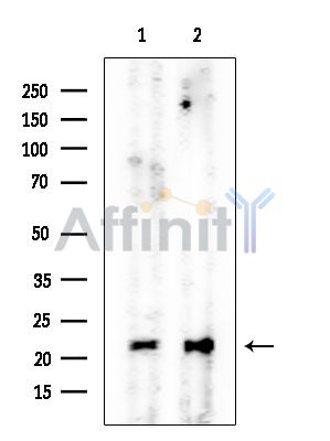 NDUFB9 Mouse Monoclonal Antibody - Western blot analysis of extracts from various samples, using NDUFB9 Mouse Monoclonal Antibody at 1/1000 dilution.