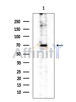 ACSL6 Mouse Monoclonal Antibody - Western blot analysis of extracts from EC304 cells, using ACSL6 Mouse Monoclonal Antibody at 1/1000 dilution.