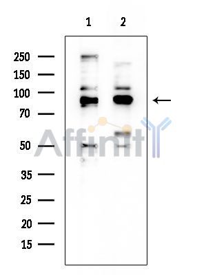 CLIC6 Mouse Monoclonal Antibody - Western blot analysis of extracts from various samples, using CLIC6 Mouse Monoclonal Antibody at 1/1000 dilution.