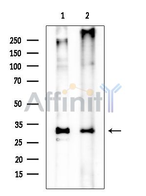 SCAMP1 Mouse Monoclonal Antibody - Western blot analysis of extracts from various samples, using SCAMP1 Mouse Monoclonal Antibody at 1/1000 dilution.