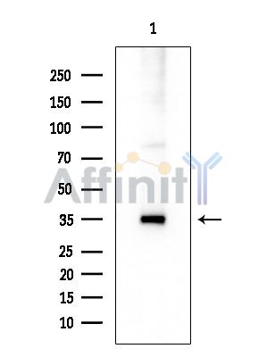 SCAMP1 Mouse Monoclonal Antibody - Western blot analysis of extracts from COLO205 cells, using SCAMP1 Mouse Monoclonal Antibody at 1/1000 dilution.