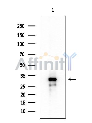 SSBP2 Antibody - Western blot analysis of extracts from EC304 cells, using SSBP2 Antibody at 1/1000 dilution.