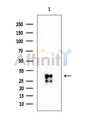 FOXE3 Antibody - Western blot analysis of extracts from EC304 cells, using FOXE3 Antibody at 1/1000 dilution.