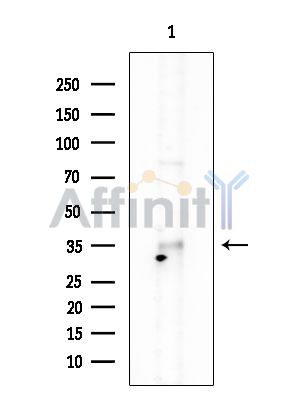 RASD2 Antibody - Western blot analysis of extracts from HUVEC cells, using RASD2 Antibody at 1/1000 dilution.