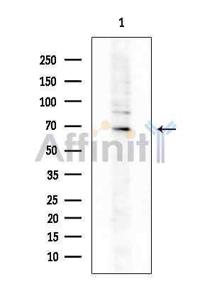 ZNF668 Antibody - Western blot analysis of extracts from COLO205 cells, using ZNF668 Antibody at 1/1000 dilution.