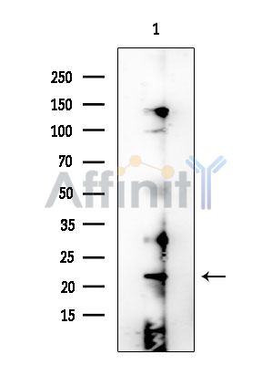 PBOV1 Antibody - Western blot analysis of extracts from EC304 cells, using PBOV1 Antibody at 1/1000 dilution.