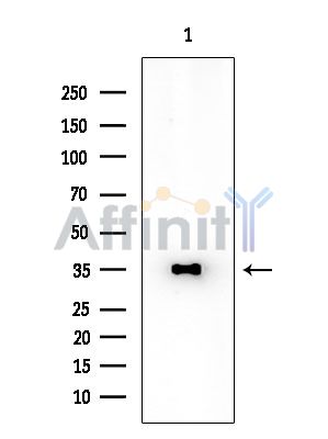 DNAJC17 Antibody - Western blot analysis of extracts from Rat brain, using DNAJC17 Antibody at 1/1000 dilution.