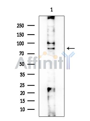 ADD2 Antibody - Western blot analysis of extracts from COLO205 cells, using ADD2 Antibody at 1/1000 dilution.