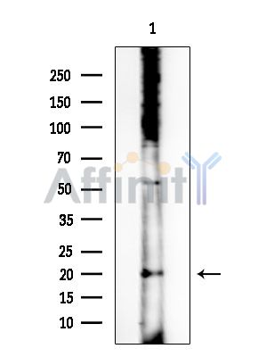 MRPL40 Antibody - Western blot analysis of extracts from EC304 cells, using MRPL40 Antibody at 1/1000 dilution.