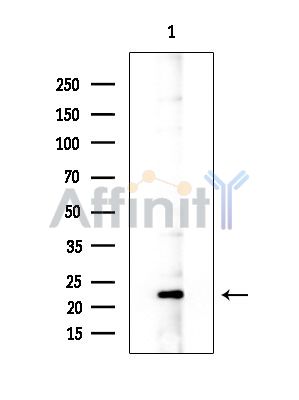 MRPL47 Antibody - Western blot analysis of extracts from Rat brain, using MRPL47 Antibody at 1/1000 dilution.