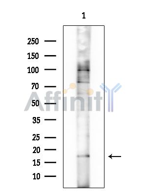 MRPL51 Antibody - Western blot analysis of extracts from Rat lung, using MRPL51 Antibody at 1/1000 dilution.