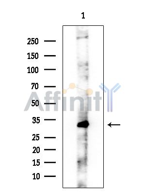 ABHD6 Antibody - Western blot analysis of extracts from EC304 cells, using ABHD6 Antibody at 1/1000 dilution.