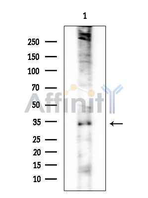 ABHD9 Antibody - Western blot analysis of extracts from EC304 cells, using ABHD9 Antibody at 1/1000 dilution.