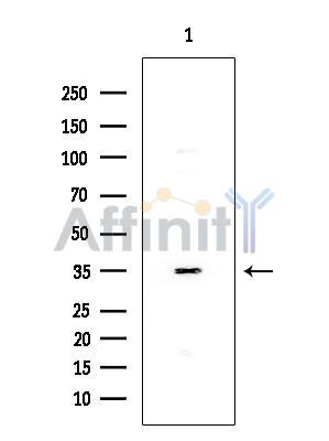 AKR1B1 Antibody - Western blot analysis of extracts from EC304 cells, using ADAM32 Antibody at 1/1000 dilution.
