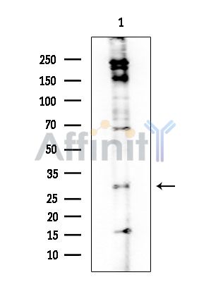 A4GNT Antibody - Western blot analysis of extracts from EC304 cells, using A4GNT Antibody at 1/1000 dilution.