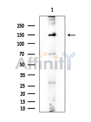 DHX8 Antibody - Western blot analysis of extracts from Rat brain, using DHX8 Antibody at 1/1000 dilution.