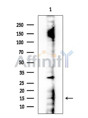 BRP44L Antibody - Western blot analysis of extracts from EC304 cells, using BRP44L Antibody at 1/1000 dilution.