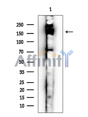 ABCC3 Antibody - Western blot analysis of extracts from COLO 205 cells(LPS treatment), using ABCC3 Antibody.