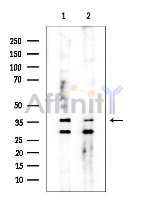 CHST8 Antibody - Western blot analysis of extracts from various samples, using CHST8 Antibody at 1/1000 dilution.