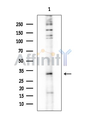 CA14 Antibody - Western blot analysis of extracts from EC304 cells, using CA14 Antibody at 1/1000 dilution.