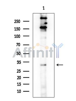 CEACAM21 Antibody - Western blot analysis of extracts from EC304 cells, using CEACAM21 Antibody at 1/1000 dilution.