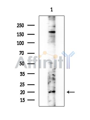 CBLN4 Antibody - Western blot analysis of extracts from Rat brain, using CBLN4 Antibody at 1/1000 dilution.