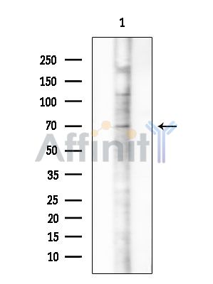 CLIC6 Antibody - Western blot analysis of extracts from Rat lung, using CLIC6 Antibody at 1/1000 dilution.