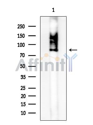C1S Antibody - Western blot analysis of extracts from HUVEC cells, using C1S Antibody at 1/1000 dilution.