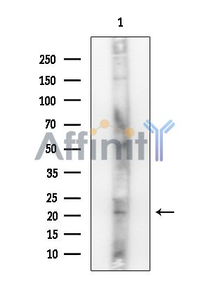 INSL4 Antibody - Western blot analysis of extracts from MCF7 cells(heat-shock treatment), using INSL4 Antibody.