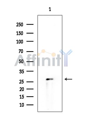 HOXA6 Antibody - Western blot analysis of extracts from HUVEC cells, using HOXA6 Antibody at 1/1000 dilution.