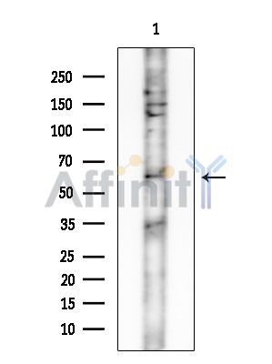 IQCB1 Antibody - Western blot analysis of extracts from HUVEC cells, using IQCB1 Antibody at 1/1000 dilution.